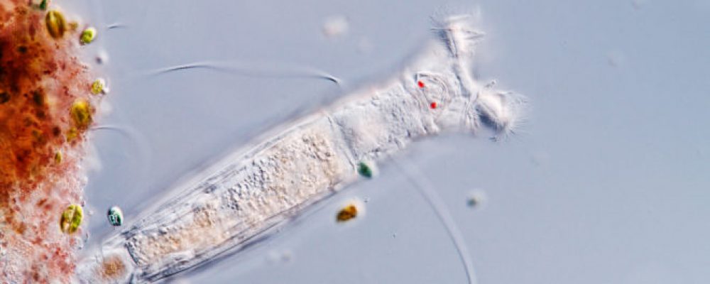 You Say Rotifer, I Say Tiny Critter With a Buzzsaw for a Face